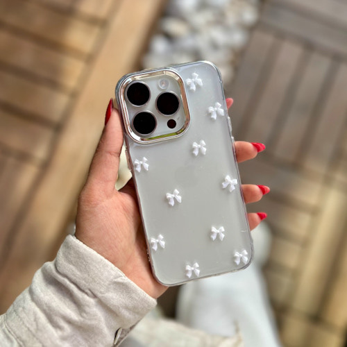 قاب شفاف شاین دار پاپیون شیائومی